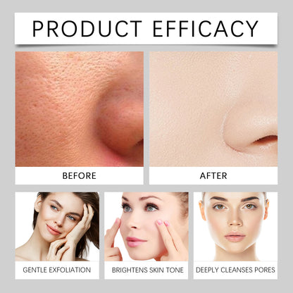 Black&White Rice Exfoliating Essence